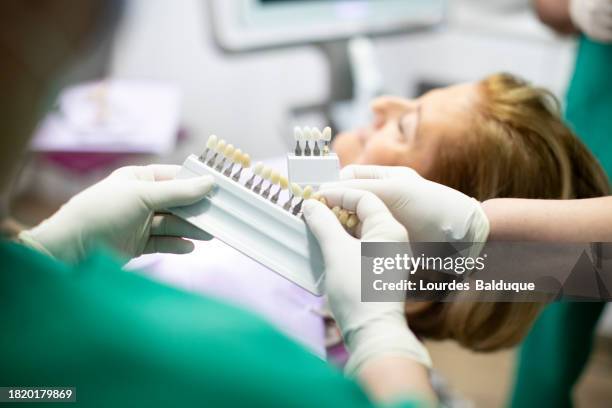 dentist and patient choosing color of implants in dental clinic - pick tooth bildbanksfoton och bilder