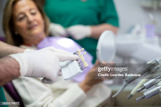 dentist and patient choosing color of implants in dental clinic - implante dentário imagens e fotografias de stock