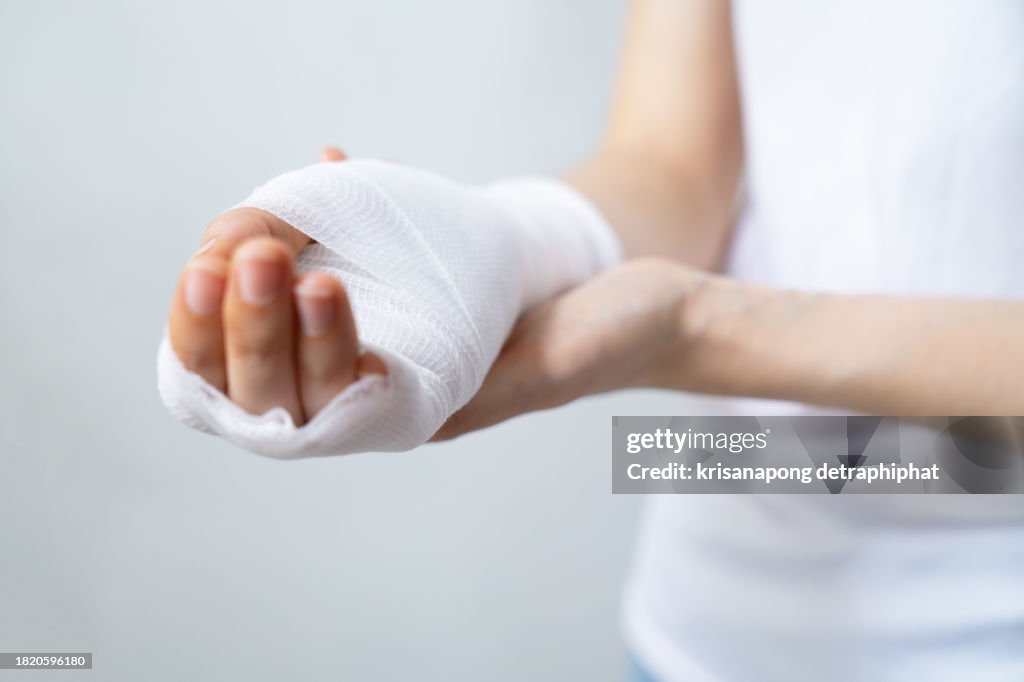 Woman with broken arms,Woman arm pain