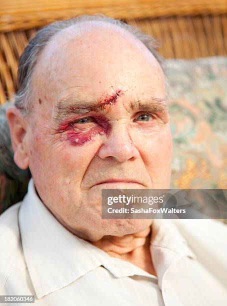 facial injury after assault - head wound stock pictures, royalty-free photos & images