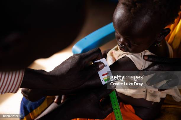 Young girl is brought into a clinic by her mother for MUAC measurements on November 29, 2023 in Rotriak, South Sudan. Climate change has divided...