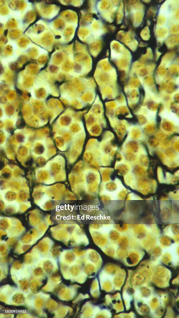 Connective Tissue--RETICULAR CONNECTIVE TISSUE, Spleen, 250X