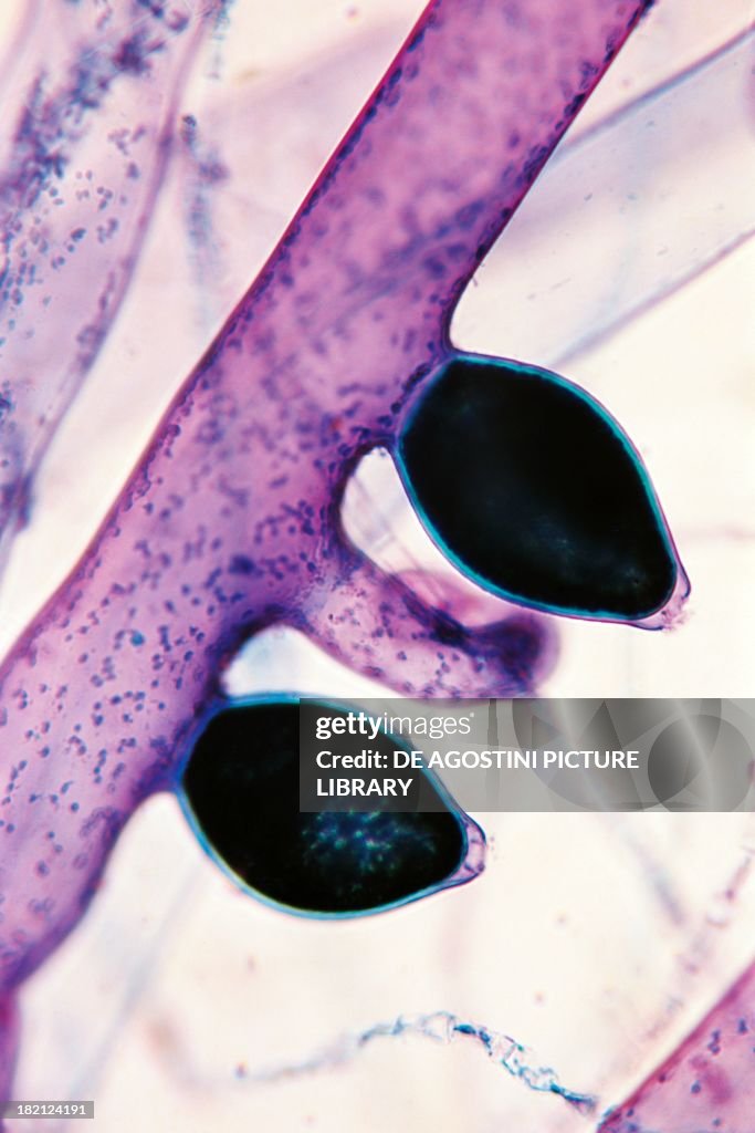 Reproductive structures of Vaucheria sessilis