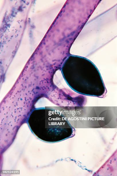 Filament with reproductive structures of Vaucheria sessilis, Vaucheriaceae, viewed under microscope.