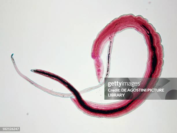 Schistosoma haematobium, Platyhelminthes, under a microscope.