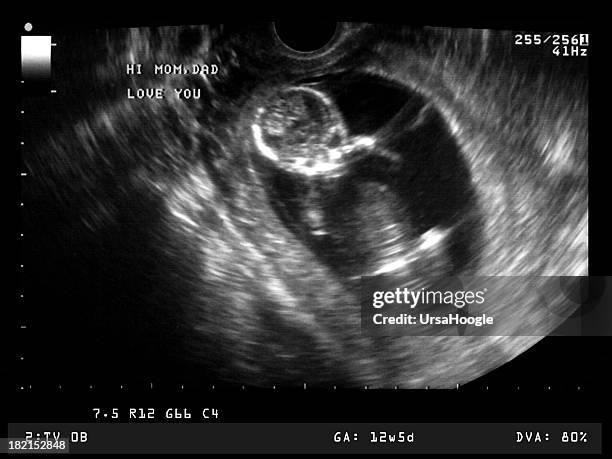la ecografía imagen de 12 semanas de edad feto - fetal position fotografías e imágenes de stock