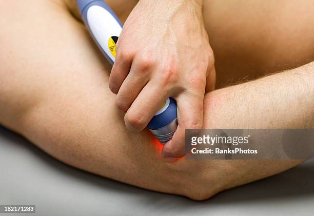 laser physical therapy - alternative therapy stock pictures, royalty-free photos & images