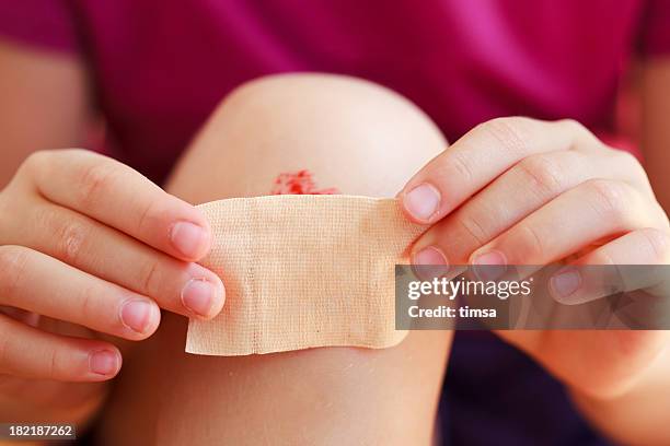 a child putting a plaster on a bloody knee - applying plaster stock pictures, royalty-free photos & images