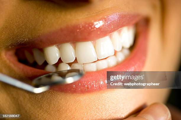 examen dental - espejo dental fotografías e imágenes de stock