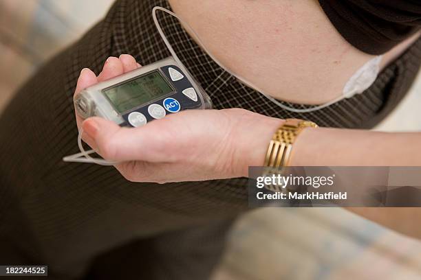 woman holding insulin pump near her hip - insulin pump stock pictures, royalty-free photos & images