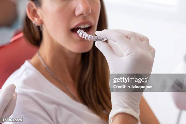 donna dentista e paziente durante la consultazione odontoiatrica - sbiancamento dentale foto e immagini stock