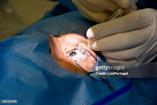 augenoperation - human eye close up stock-fotos und bilder