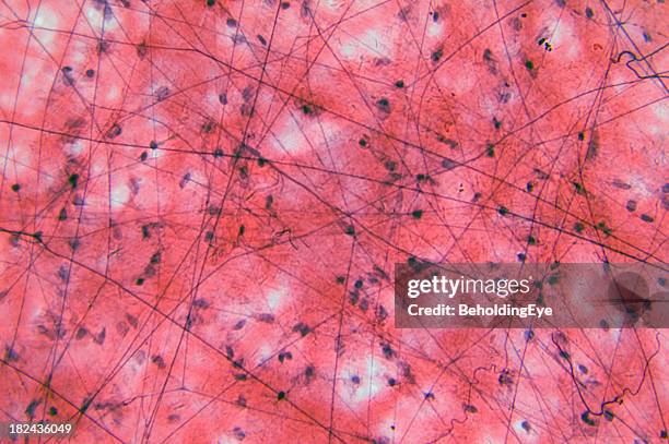 magnified image of loose connective tissue - cartilage bildbanksfoton och bilder