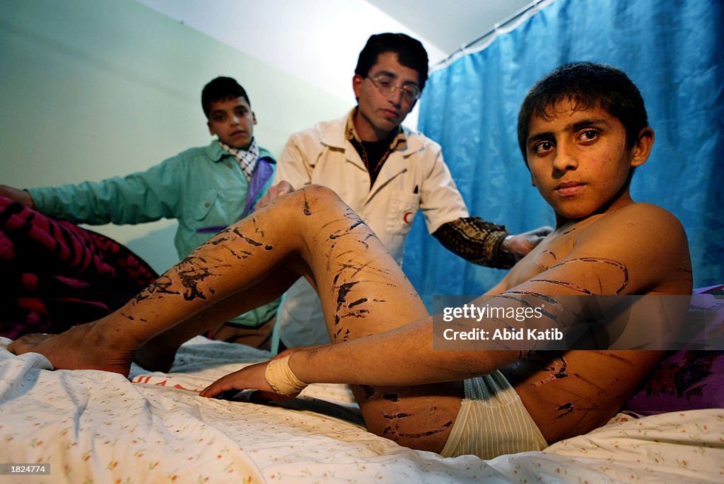 Gaza Hospital Treats Palestinian Boy Beaten By Israeli Soldiers