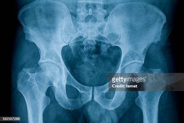 pelvis - hip body part stock pictures, royalty-free photos & images