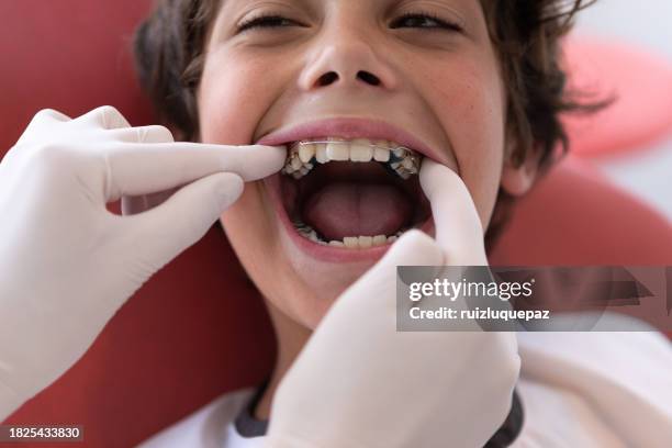 dentist woman and teenager boy patient during dental consultation - mouth open stock pictures, royalty-free photos & images