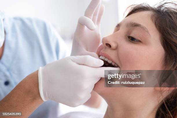 dentist woman and teenager patient during dental consultation - aparelho dentário imagens e fotografias de stock