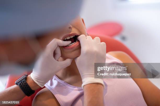 mujer dentista y paciente adolescente durante consulta dental - amoldar fotografías e imágenes de stock