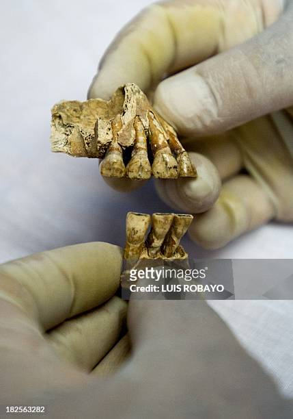 An archaeologist holds dental pieces that belonged to a pre-Hispanic indigenous man at the Pre-Hispanic Ossuarty in Cali, Colombia, on September 30,...