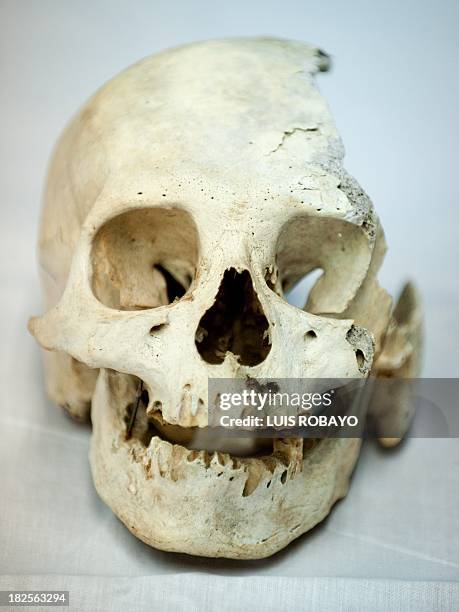 View of a skull of pre-Hispanic indigenous woman at the Pre-Hispanic Ossuarty in Cali, Colombia, on September 30, 2013. The ossuary preserves some...