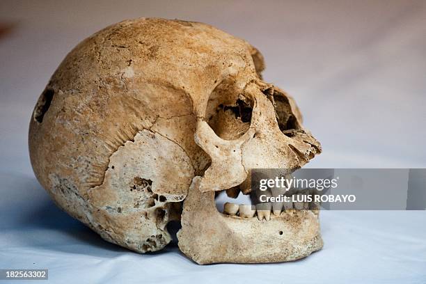 View of a skull of pre-Hispanic indigenous man at the Pre-Hispanic Ossuarty in Cali, Colombia, on September 30, 2013. The ossuary preserves some 250...