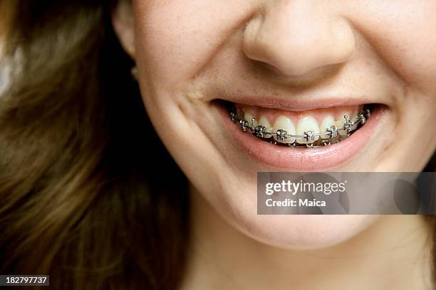 bretelles dentaires - human mouth stock photos et images de collection