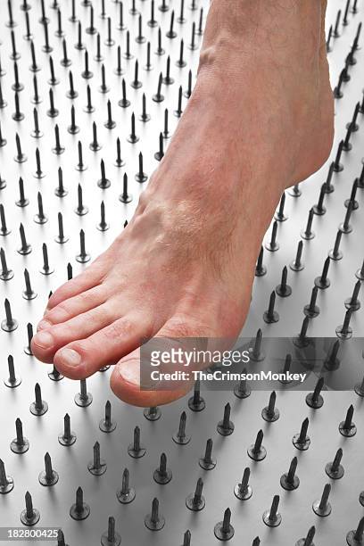 diabetic foot pain - pointed foot stock pictures, royalty-free photos & images