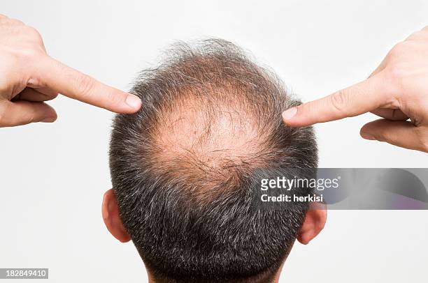 balding - receding stock pictures, royalty-free photos & images