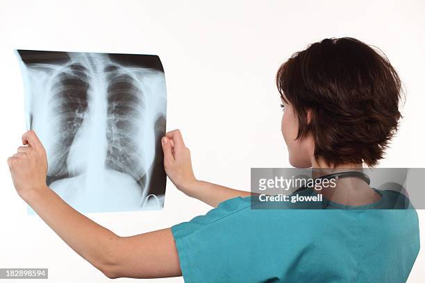 femmina medico con raggi x di polmoni - tuberculosis foto e immagini stock