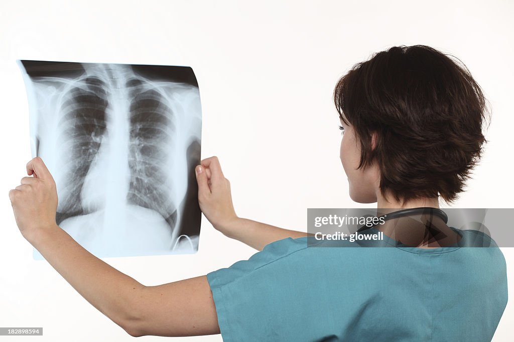 Female doctor - lungs X-Ray