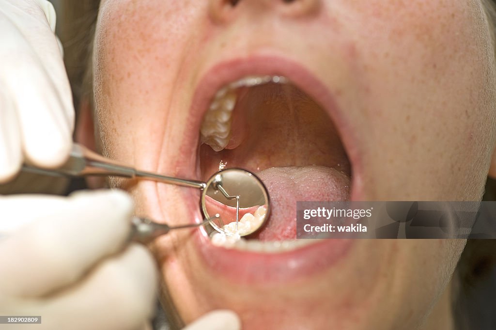 Patient at dentist with open mouth during treatment on teeth