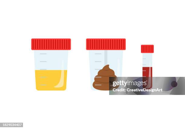 illustrazioni stock, clip art, cartoni animati e icone di tendenza di campioni di urina, feci e sangue per analisi di laboratorio. contenitori con biomateriale per la diagnostica medica delle malattie - provetta per campioni ematici