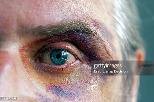 black eye, close-up - blaues auge stock-fotos und bilder