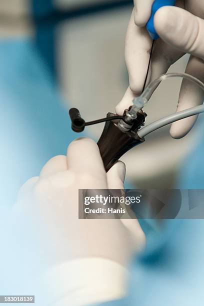 laparoscopy - laparoscopy stockfoto's en -beelden