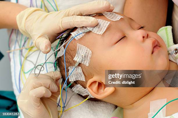 hands applying electrodes to baby for electroencephalography - brain activity stock pictures, royalty-free photos & images