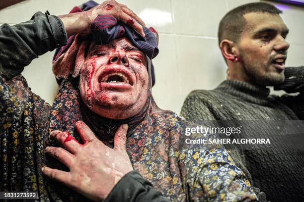 Khan Yunis, Palestine. Following an Israeli airstrike on December 7 a Palestinian woman injured in the attack has been transported to Nasser Medical...