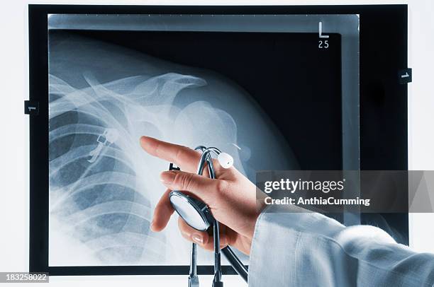 doctor pointing at xray with stethoscope in hand - x ray arm stock pictures, royalty-free photos & images