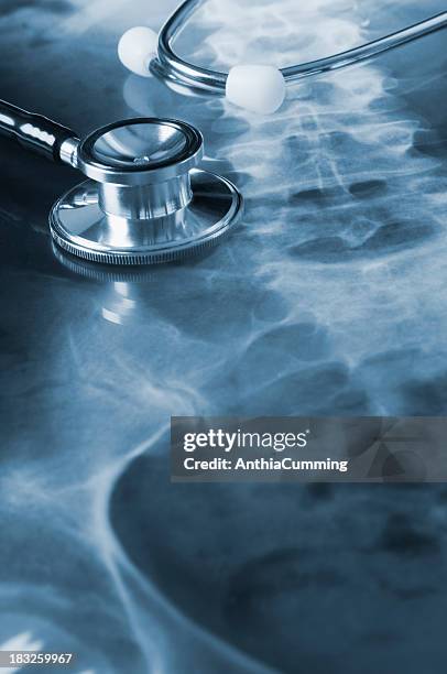 arzt stethoskop auf dem bauch liegen ein xray der hüfte - röntgenaufnahme stock-fotos und bilder
