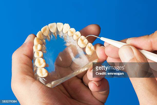 dentist examining prothèse - prothèse stock pictures, royalty-free photos & images