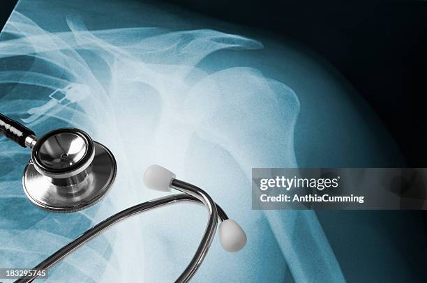 close-up of a stethoscope laying on an x-ray for healthcare - shoulder anatomy stock pictures, royalty-free photos & images