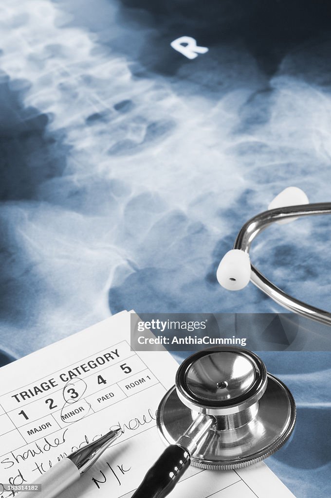 Médicos triagem notas, Estetoscópio e caneta sobre uma radiografia de