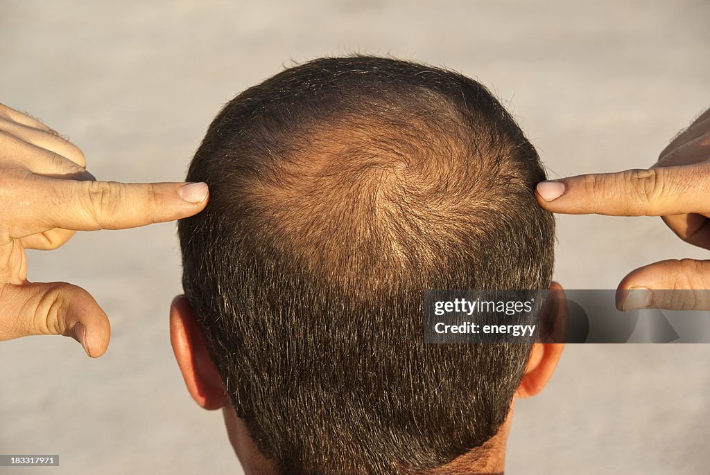 Um bald