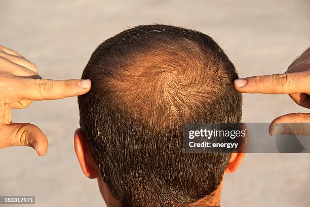 pour devenir chauve - balding photos et images de collection