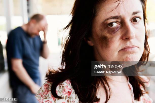 resentful bruised woman with desperate looking man in  background - rea001 stock pictures, royalty-free photos & images