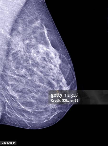 mammogram - mammogram stock pictures, royalty-free photos & images