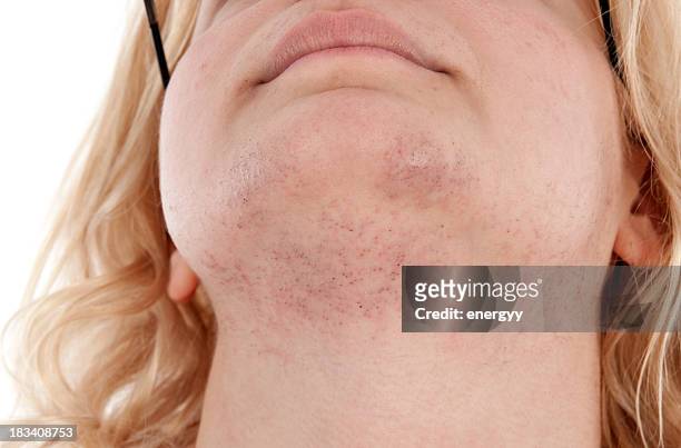 918,243 Facial Hair Photos and Premium High Res Pictures - Getty Images