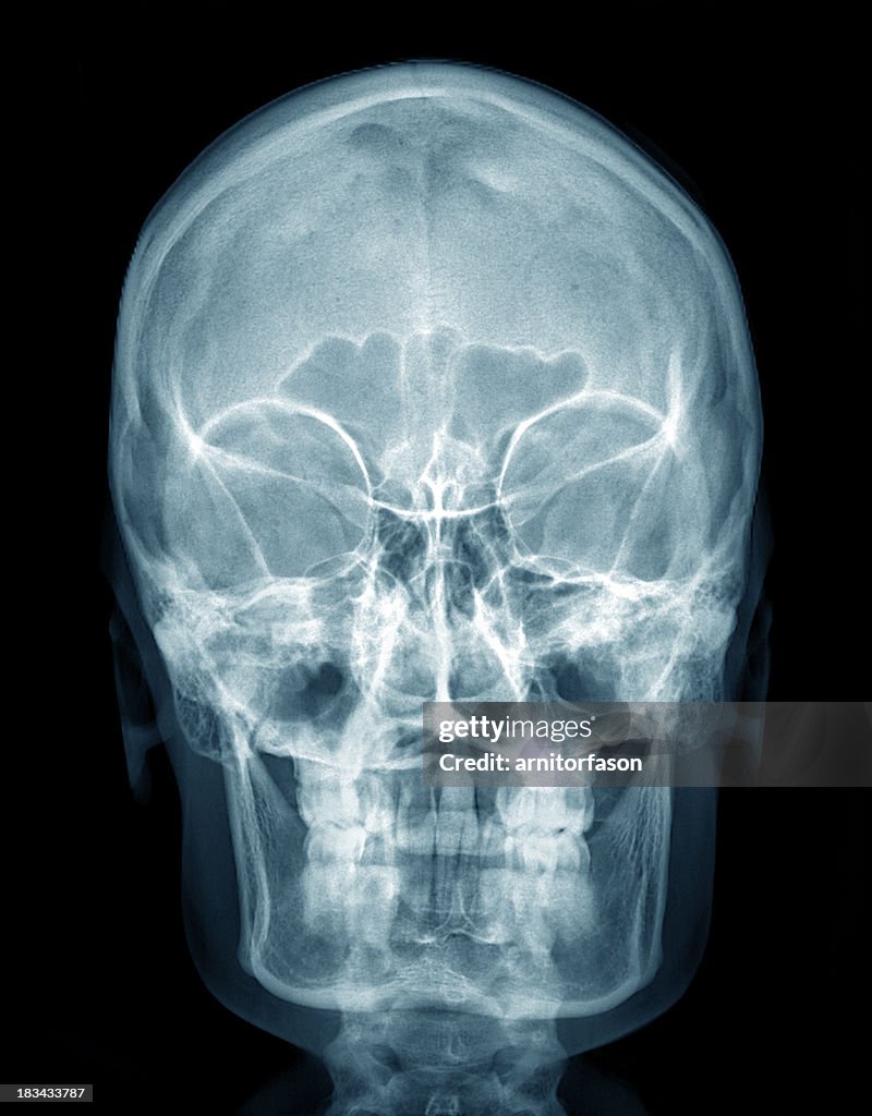 X-ray Menschlicher Kopf