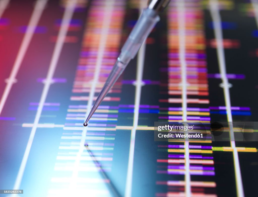 Random Dna Sample Droplet Of Dna Sample Through Pipette Over Research Data High-Res Stock ...