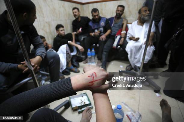 Writings are seen on the hand of a Palestinian who was released after being arrested by Israeli soldiers in the Shucaiyye District in the east of...