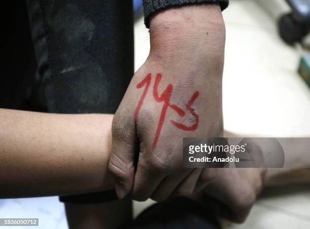Writings are seen on the hand of a Palestinian who was released after being arrested by Israeli soldiers in the Shucaiyye District in the east of...